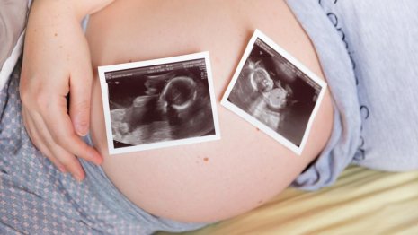 Gemäss einer Studie, an der IVI beteiligt ist, reduziert vaginales Progesteron die Frühgeburtenrate und Komplikationen bei Zwillingsschwangerschaften bei Frauen mit verkürzter Zervix